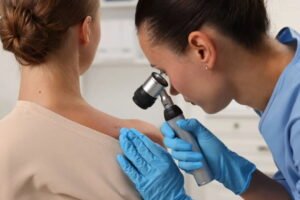 Skin Cancer Specialist